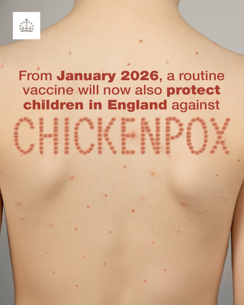 UK Government to offer FREE chickenpox vaccination offered for 1st time to children