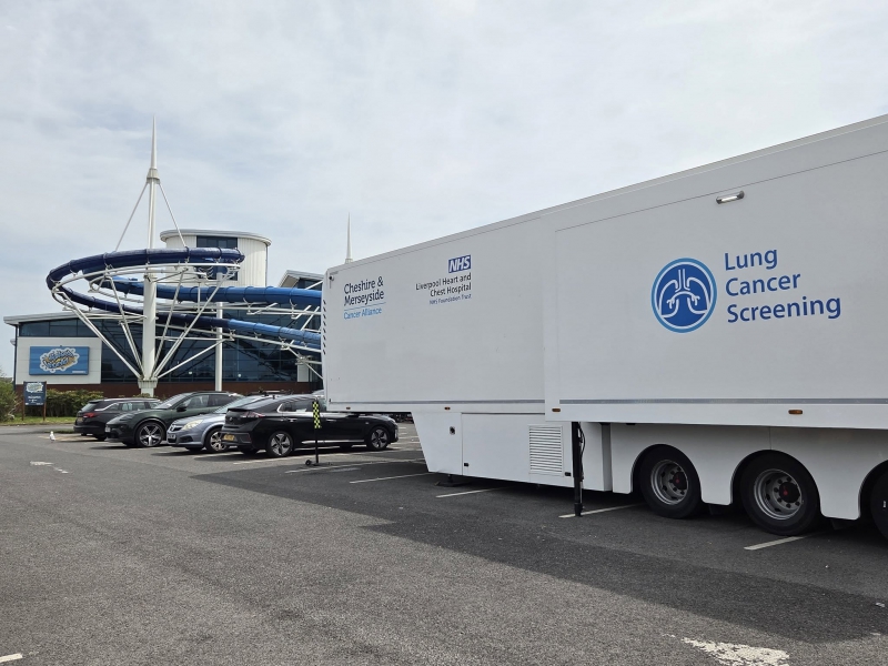 Exceptional Uptake Highlights Success of Southport and Formby Lung Cancer Screening Programme