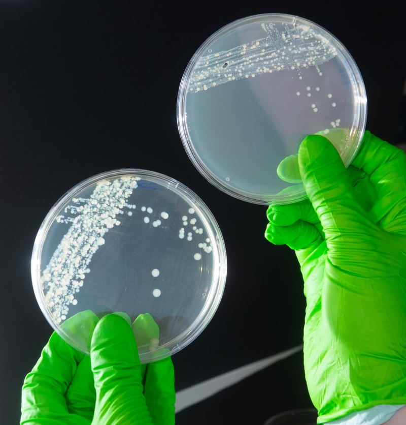 Public Health Chiefs call on workers to step up handwashing after workplace kitchen swabbing 